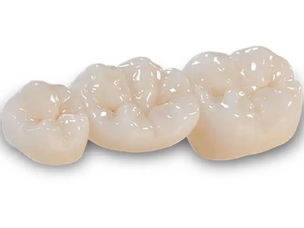 Dental Crowns